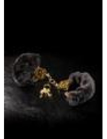 Ff Gold Deluxe Furry Cuffs